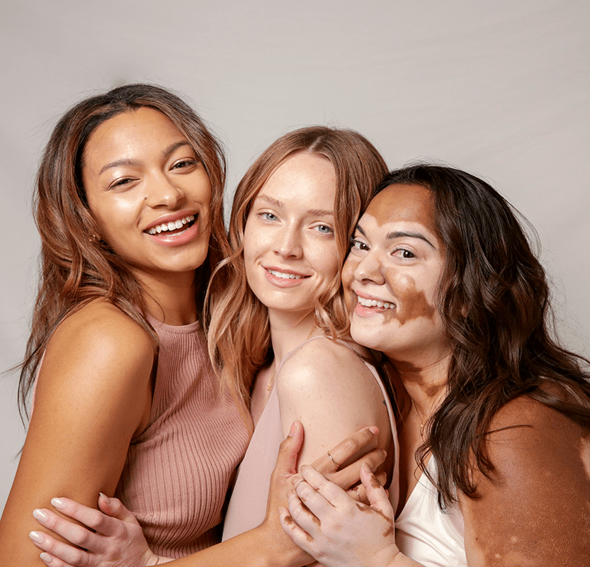 Embrace Your Skinversity