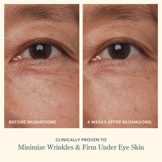 Before and after side by side image of up close shot of models eyes 4 weeks after using Beekman 1802's Mushroom Milk Better Aging Eye Cream and with the words at the bottom saying "clinically proven to minimize wrinkles & firm under eye skin"