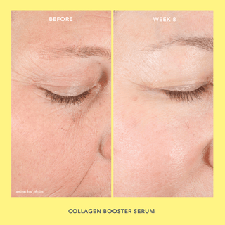 A before and after image of models eye and face wrinkles showing after 8 weeks, their skin has become tighter and less wrinkles by using the Collagen Booster.