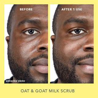 A before and after image of models skin when he used the Milk Scrub facial cleanser, revealing brighter, healthier skin.