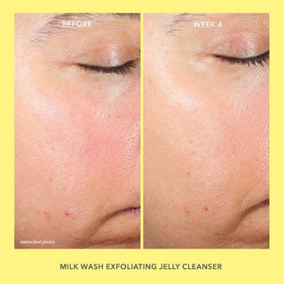 Before and after image of how to use Beekman 1802's Milk Wash Jelly Cleanser, showing less red, clean skin on the right.