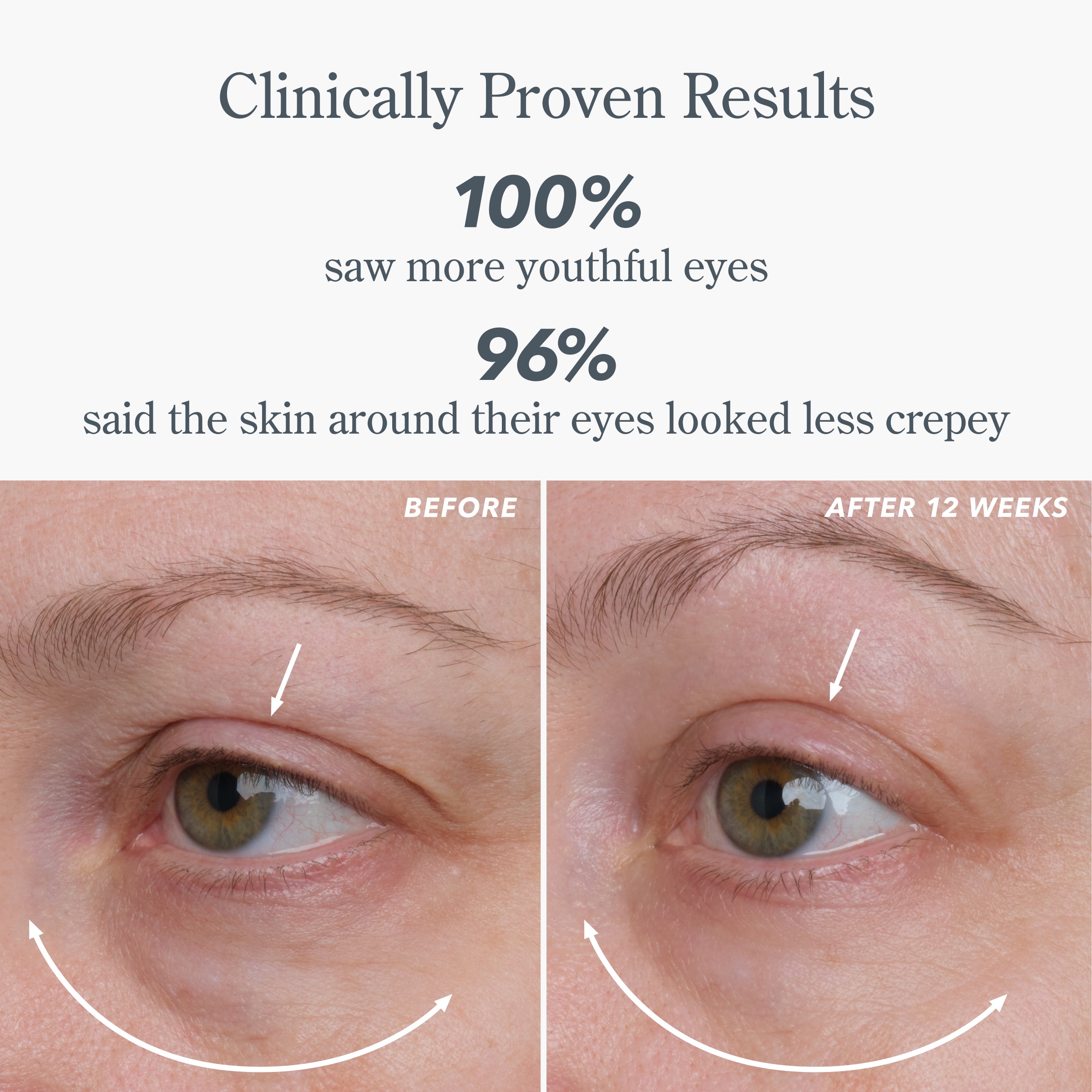 Milk RX Advanced Better Aging Dual Eye Treatments