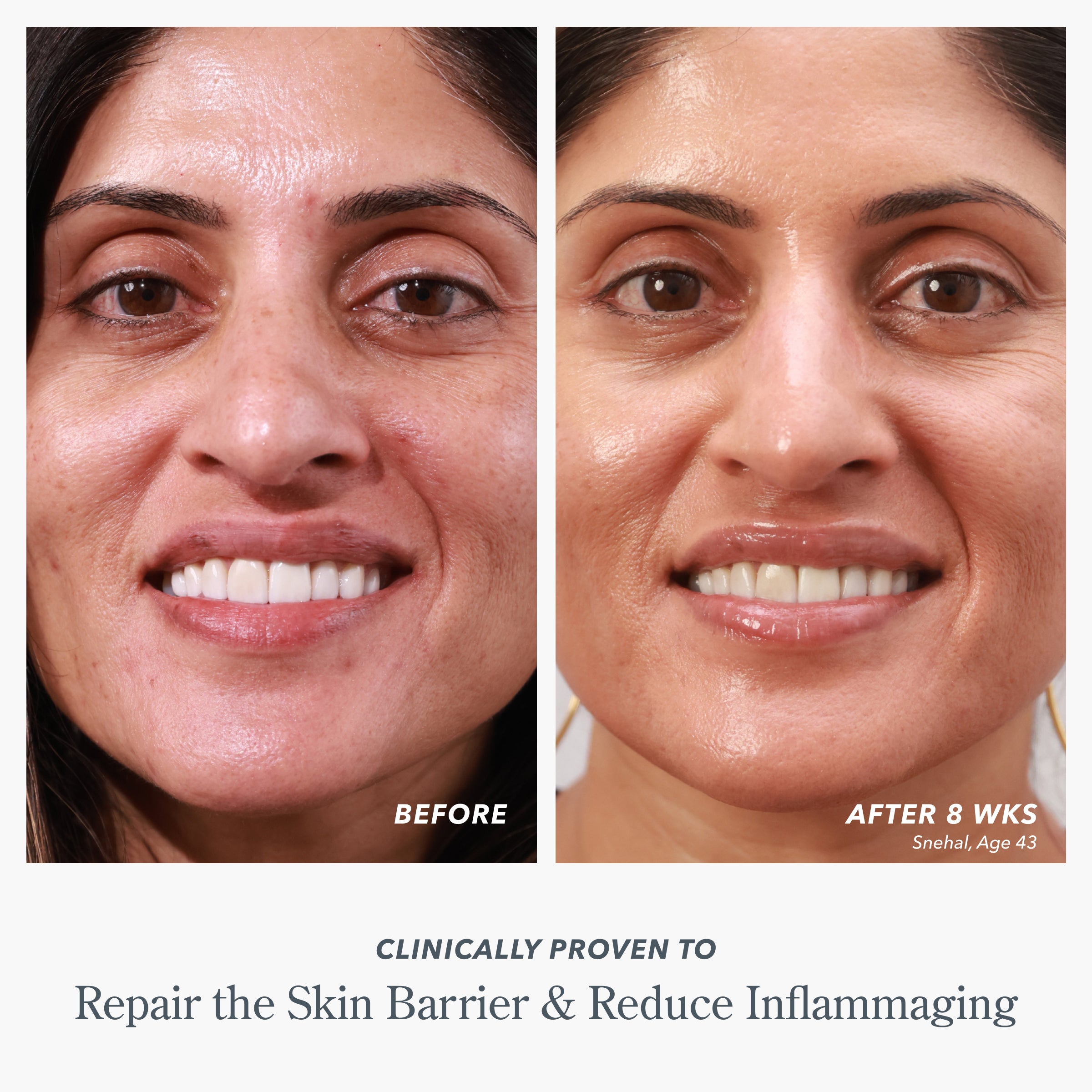 Milk RX Advanced Better Aging Cream