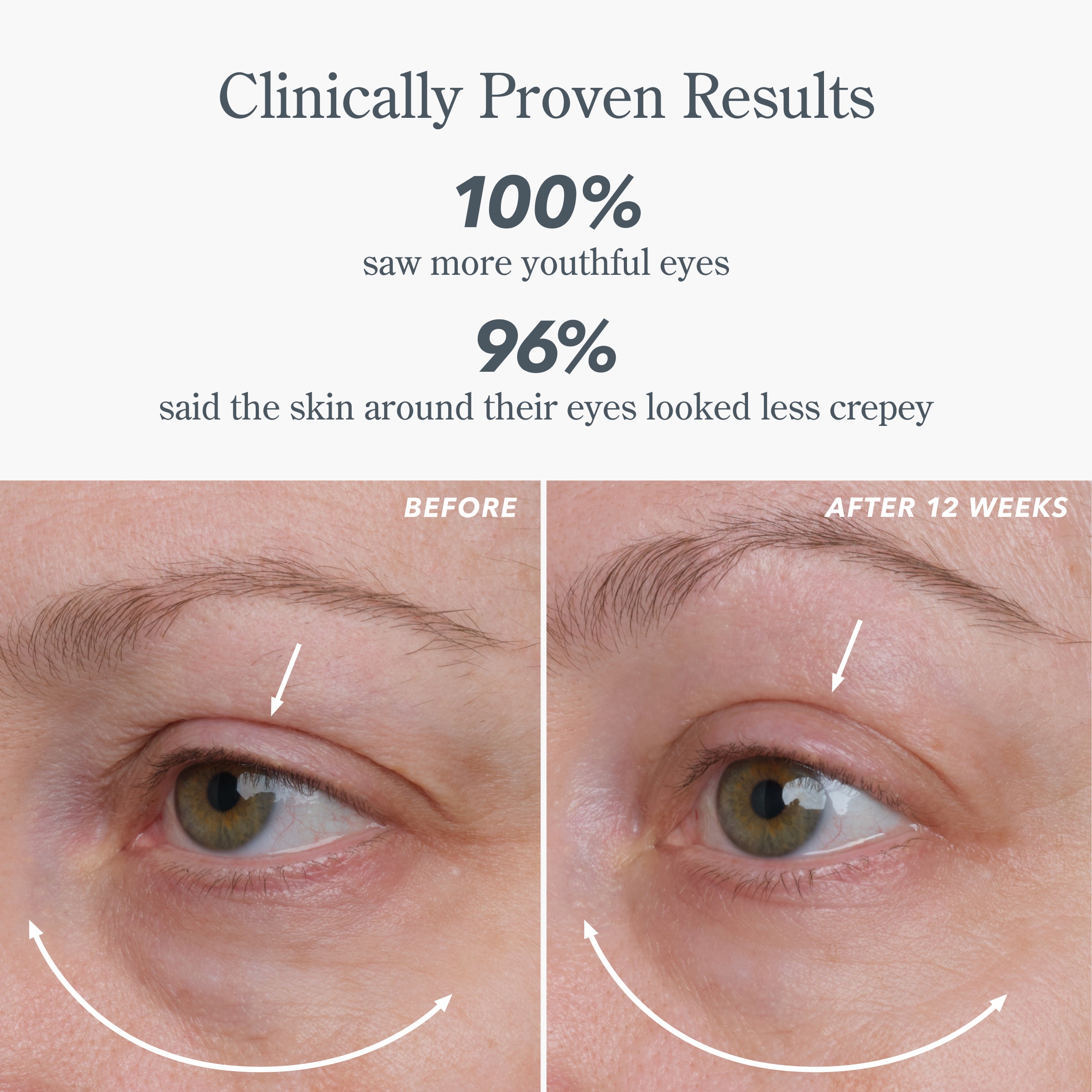 Milk RX Advanced Better Aging Dual Eye Treatments