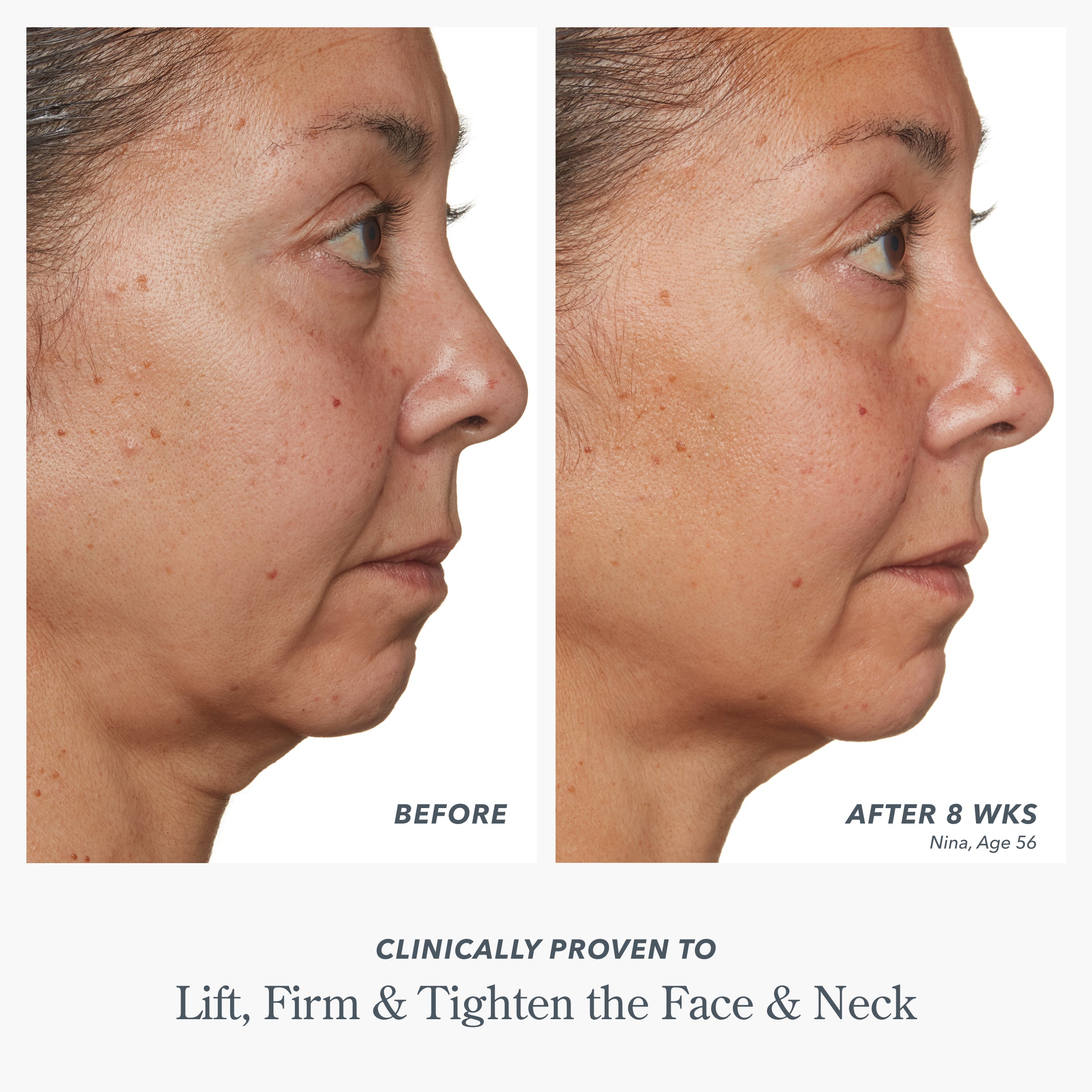 Milk RX Advanced Better Aging Cream