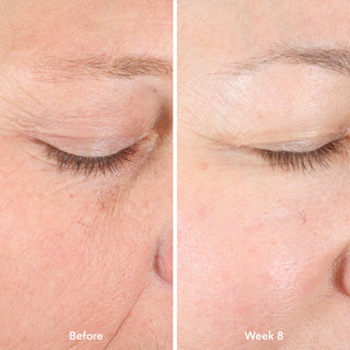 Before and after image of Collagen Booster reducing fine lines and wrinkles over time.
