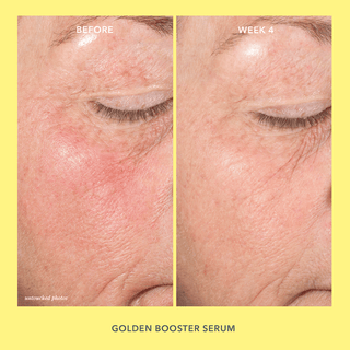 Before and after image of using Golden Booster Vitamin C brightening Serum.
