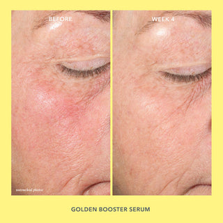 Before & After Golden Booster Amla Berry Vitamin C Brightening Serum