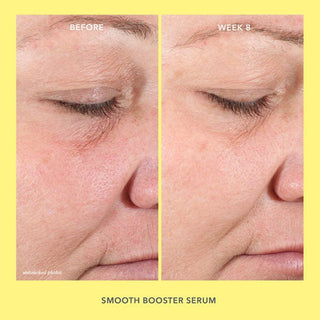 Smooth Moves Skincare Set Before & After