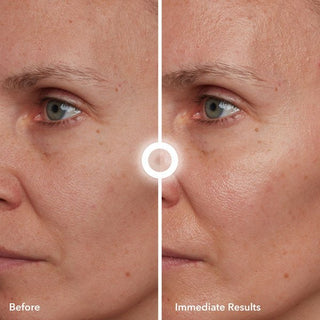 Before and after of using the oh mega milk, revealing hydrated skin immediately.